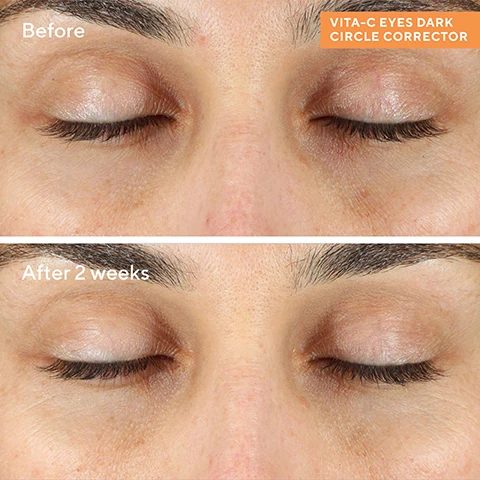 image 1, Before. After 2 weeks. image 2, 86% saw brighter eye area skin at 2 weeks. 85% saw a reduction in dark circles at 6 weeks. image 3, VITA-C EYES DARK CIRCLE CORRECTOR. VITA-C COMPLEX. Delivers higher antioxidant defense, is highly bioavailable for increased absorption + ensures the stability and potency of vitamin C in skin. RED + BROWN ALGAE EXTRACTS Visibly de-puff + soothe under-eye area. LIGHT-REFLECTING MICRO-MINERALS Instantly brighten eye area. CUCUMBER EXTRACT Hydrates to visibly smooth wrinkles. image 4, recharge while you sleep and wake up to glowy skin. 1 = cleanse with essential c cleanser, rinse and pat dry. 2 = 1-3 times a week massage vita-c triple exfoliating facial over skin. let absorb for 10 minutes, then pat dry. 3 = pat vita-c dark circle corrector under eyes. 4 = smooth essentual c overnight barrier repair cream over face, neck and chest