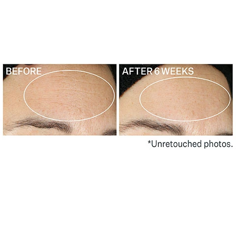 Image 1, before and after 6 weeks, unretouched photos. Image 2, prebiotic (bacillus ferment) blend, sourched from french hot springs in the volcanic auvergne region of france, this first of its kind, prebiotic fatty acid complex combines bacillus ferment with jojoba and oat oils to support the microbiome. Image 3, ways to use super-b oil in your routine. 1 = alone, 2 = mix with moisturizer, 3 = apply over moisturizer