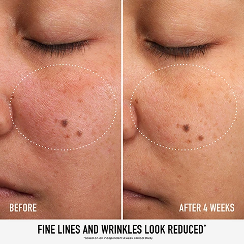 Image 1, before and after 4 weeks. fine lines and wrinkles look reduced. based on an independent 4 week clinical study. image 2, routine to the rescue. start with clean, dry skin. step 1 = smooth with skin rescue pure smooth serum with 5% niacinamide and chebula. AM step 2 = hydrate with skinlongevity phyto vitamin c brightening moisturiser mineral SPF 30. PM step 2 = strengthen with skin longevity long life herb night treatment. step 3 = restore with skin longevity long life herb eye treatment. image 3, rescue your skin. step 1 = squeeze serum into your palm. step 2 = pat into clean, dry skin. step 3 = wait 5 minutes. step 4 = finish with moisturiser, adding SPF in the morning. image 4, dual patented sensitive base = backed by 10 years of research. chebula = helps treat sun damage and skin aging. 5% niacinamide = improves cell metabolism and skin texture. image 5, clean with a conscience = good for you formulas that are good for the planet too. ethically sourced = pure, potent ingredients. sustainably made = infinitely recyclable glass bottle and dropper in an FSC-certified carton. image 6, clinically proven. fights signs of aging in 7 days. instantly reduces fine lines and wrinkles by 41%. based on an independent clinical study. image 7, how to recycle. 1 = remove post consumer recycled plastic cap from bottle. 2 = remove glass dropper from cap, rinse and recycle. 3 = rinse glass and bottle and recycle. image 8, clinically proven. significantly improve the condition of skin in 1 week. based on an independent clinical study.